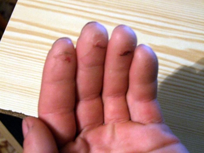 Prstíky po přelezení