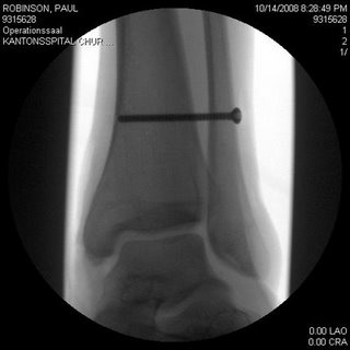 Paulův RTG Paulův RTG